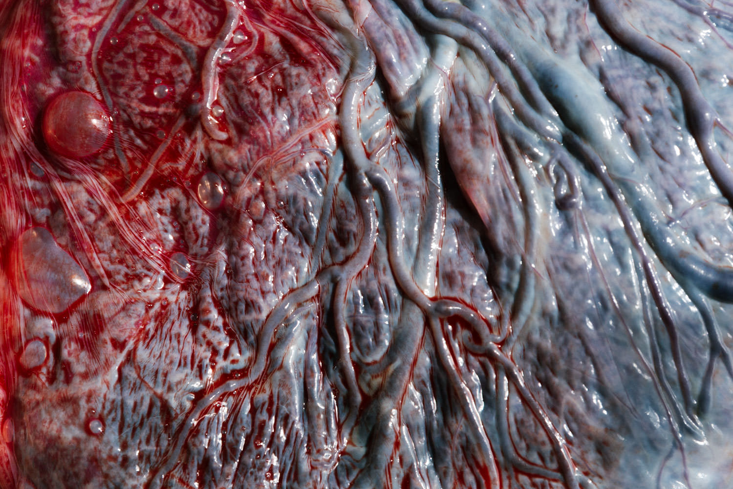 Reportage accouchement Collectif Carmin