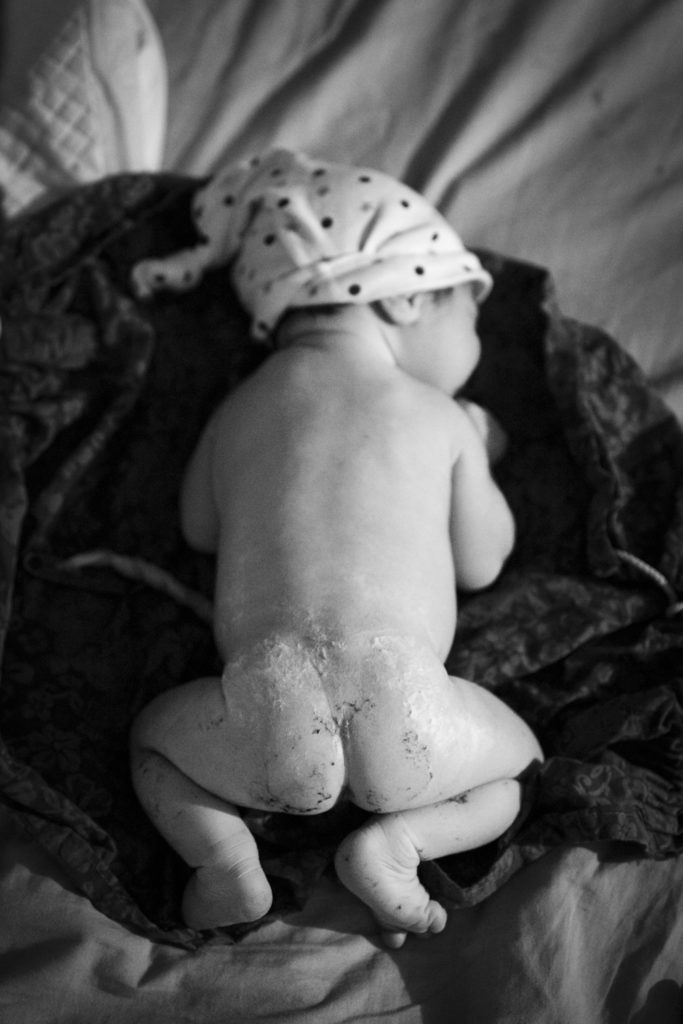 Reportage d'accouchement collectif carmin