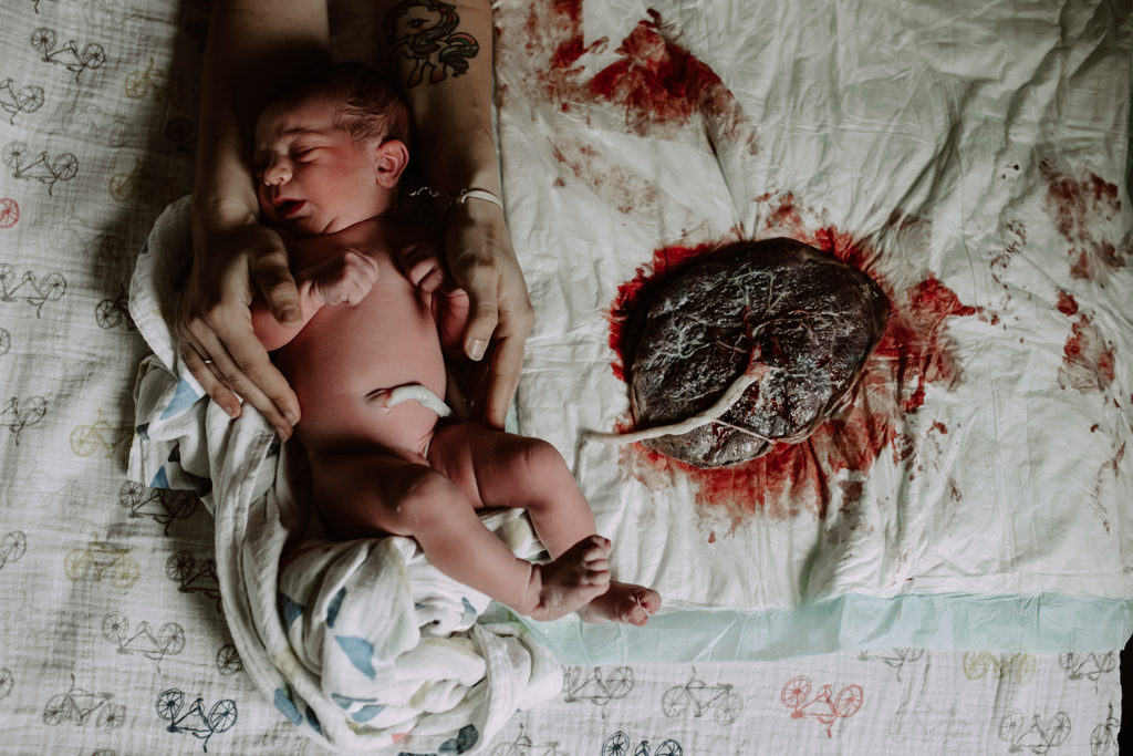 Reportage d'accouchement collectif carmin