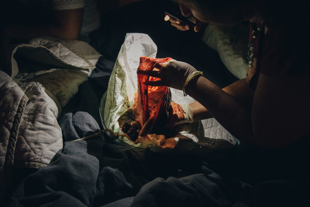 Reportage d'accouchement collectif carmin