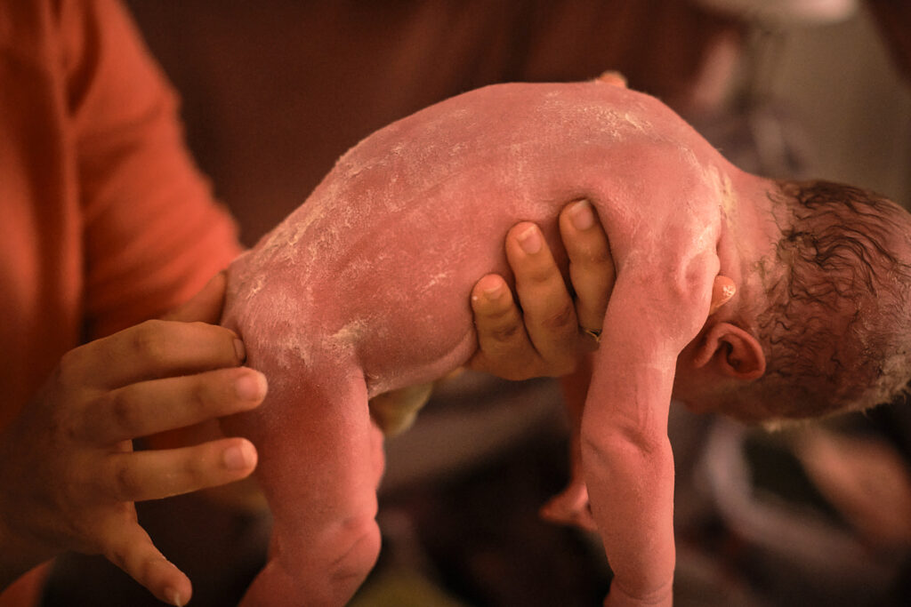 Reportage d'accouchement Collectif Carmin