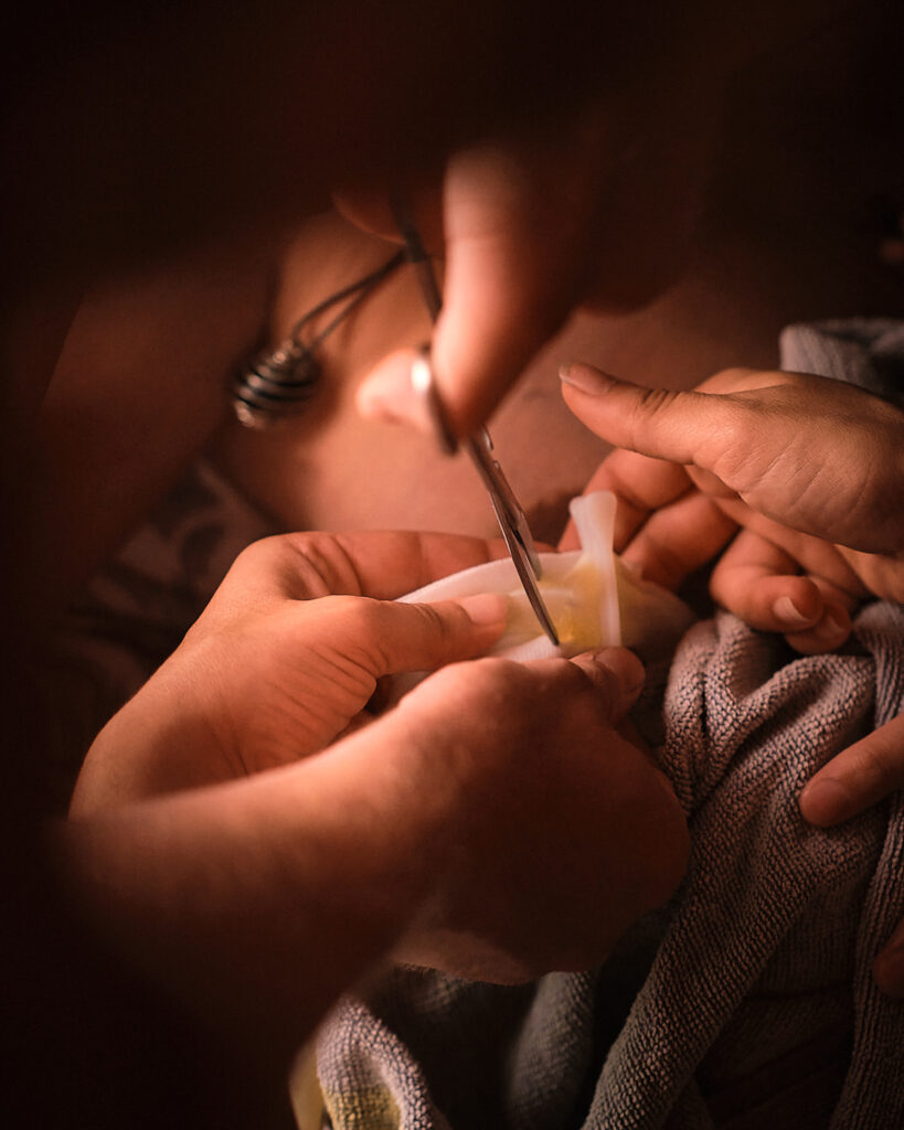 Reportage d'accouchement Collectif Carmin