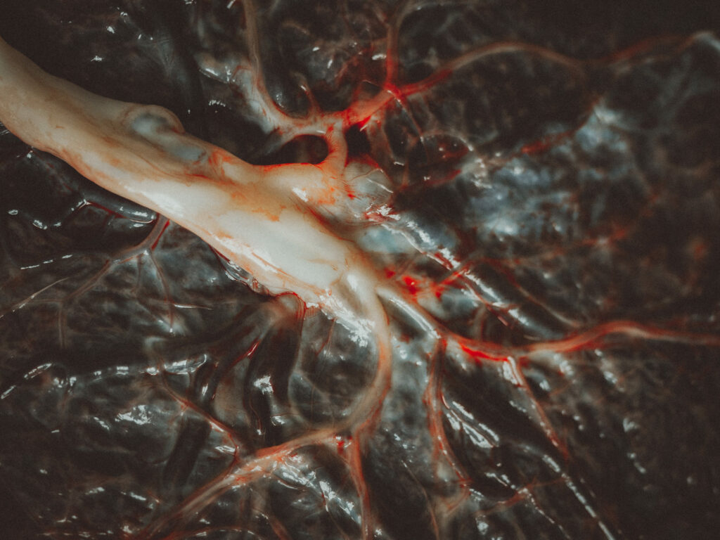 Reportage d'accouchement Pauline Clerget Collectif Carmin