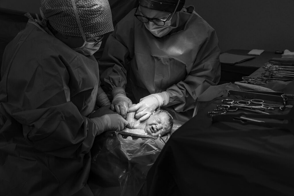 Reportage d'accouchement Matthieu Heime Collectif Carmin